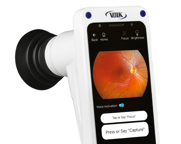 【2022 红点奖】VistaView / 视网膜相机
