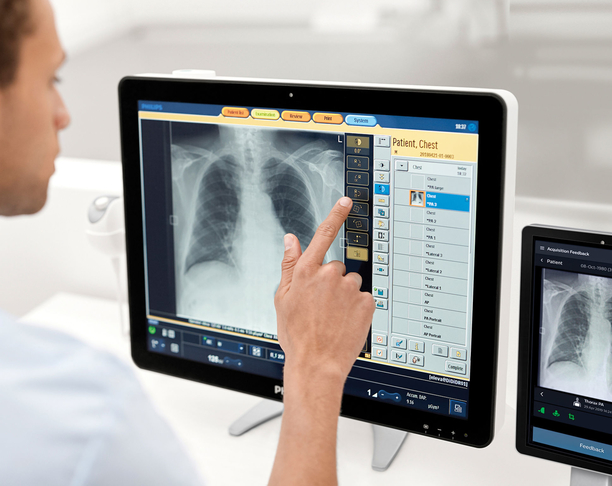 【2022年 iF设计奖】Philips Radiology Smart Assistant