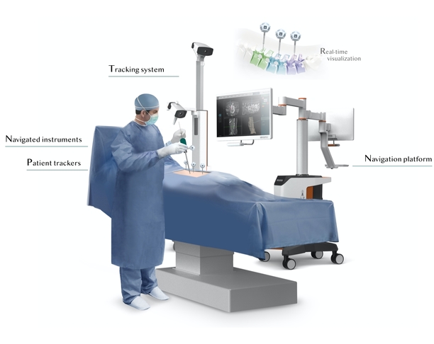 【2023年 iF设计奖】Continuous Tracking Surgical Assistance System