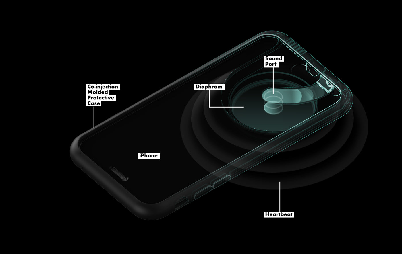 Stethoscope，Steth I，modernization，intelligence，