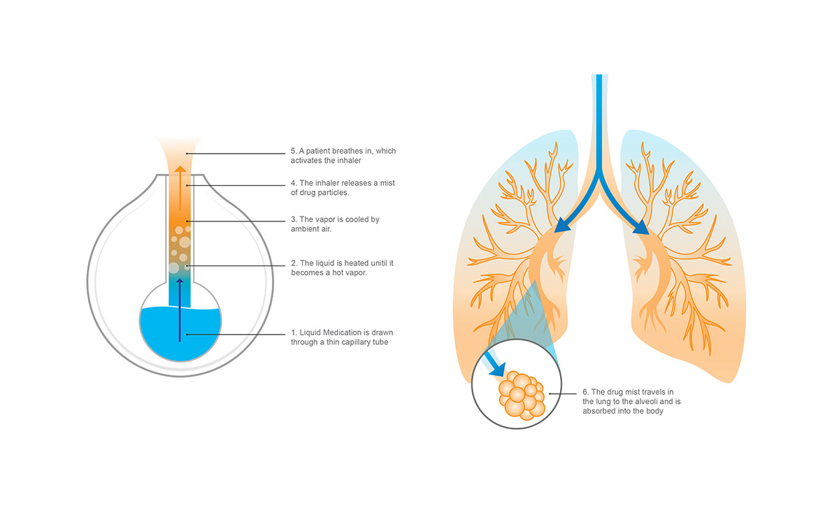 User analysis，crowd，User experience，Inhaler，asthma，Red dot award，