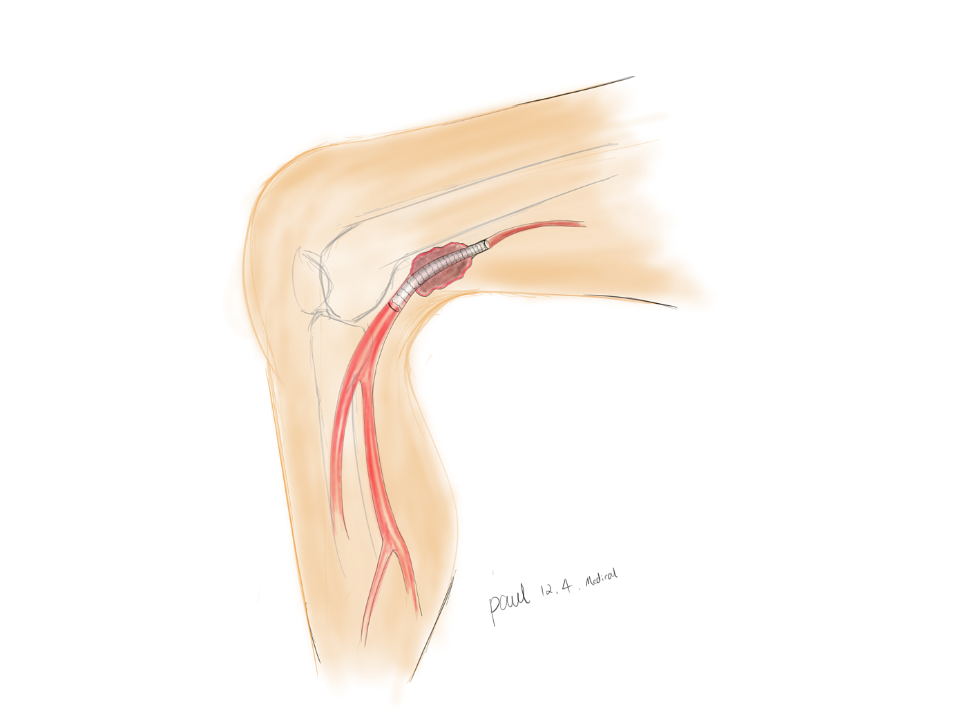 Medical illustration，medical apparatus and instruments，Posters，