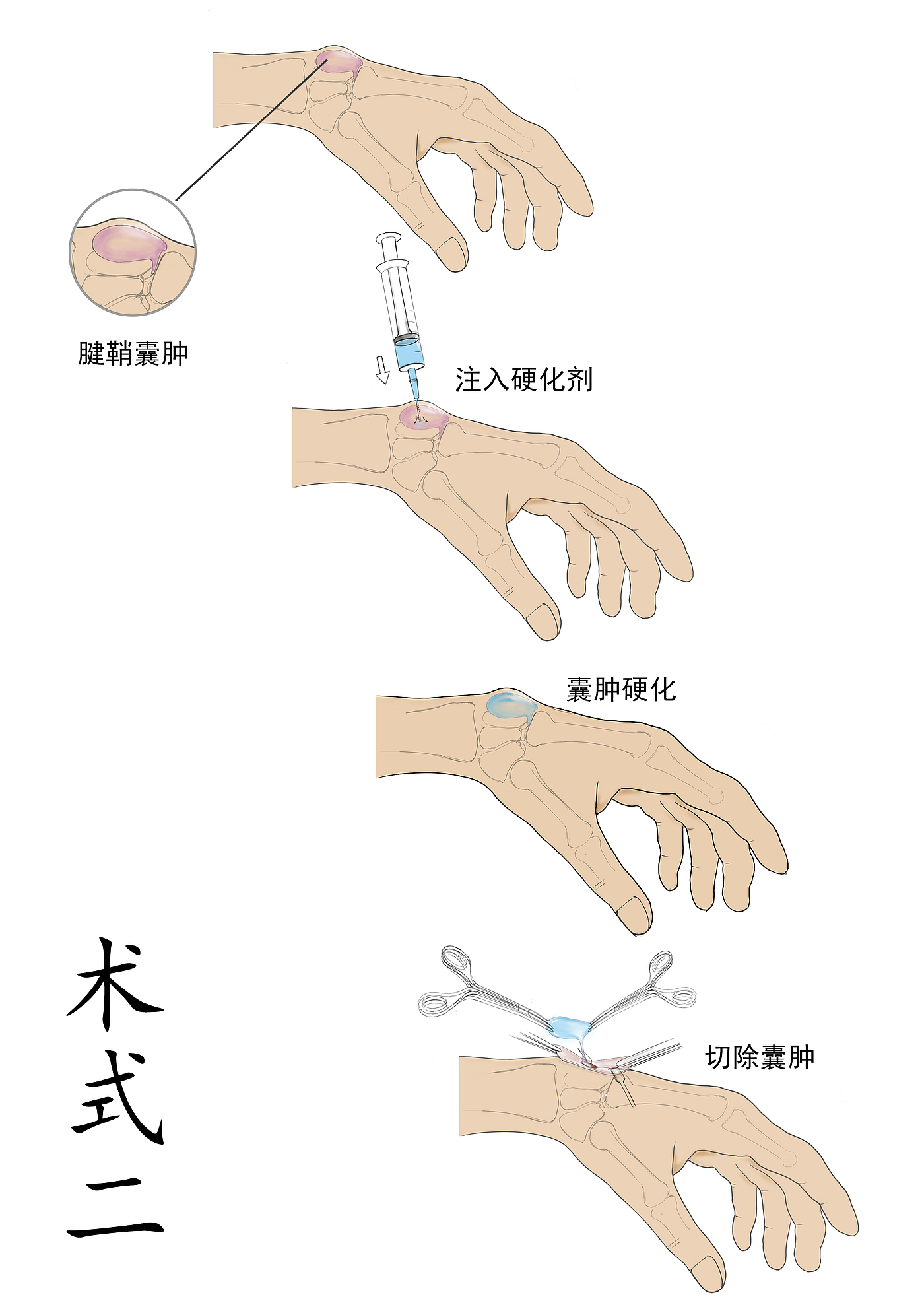 手术术式，人机工程，人机交互，