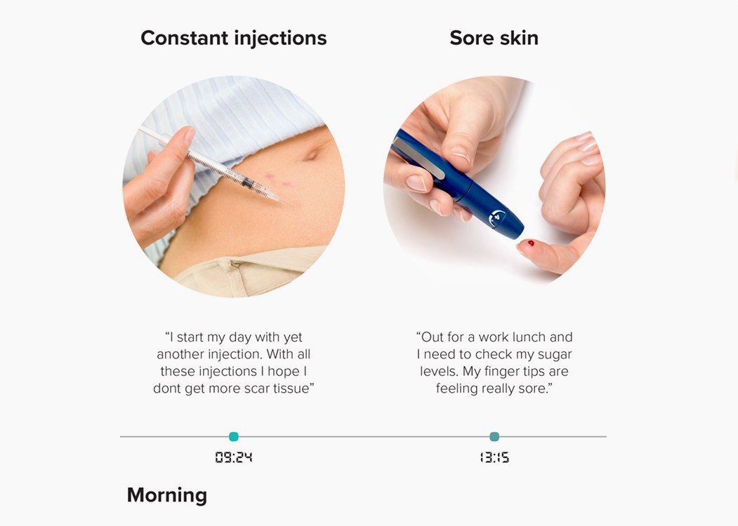 Kite exchange daily insulin injection，