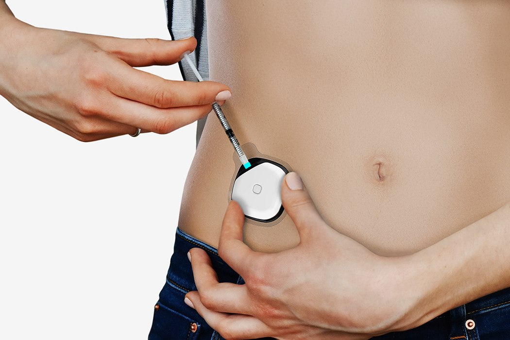 Kite exchange daily insulin injection，