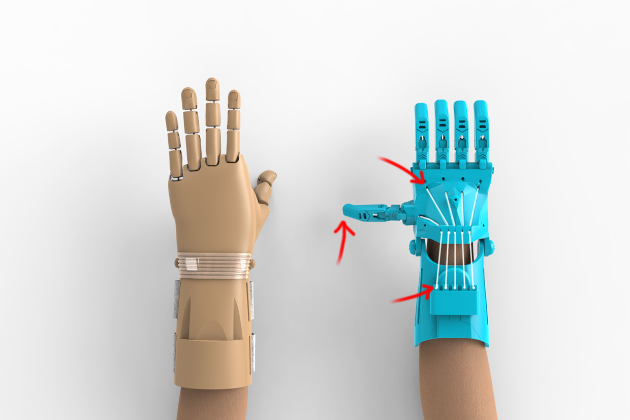 medical，Artificial hand，anthropomorphic ，industrial design，product design，