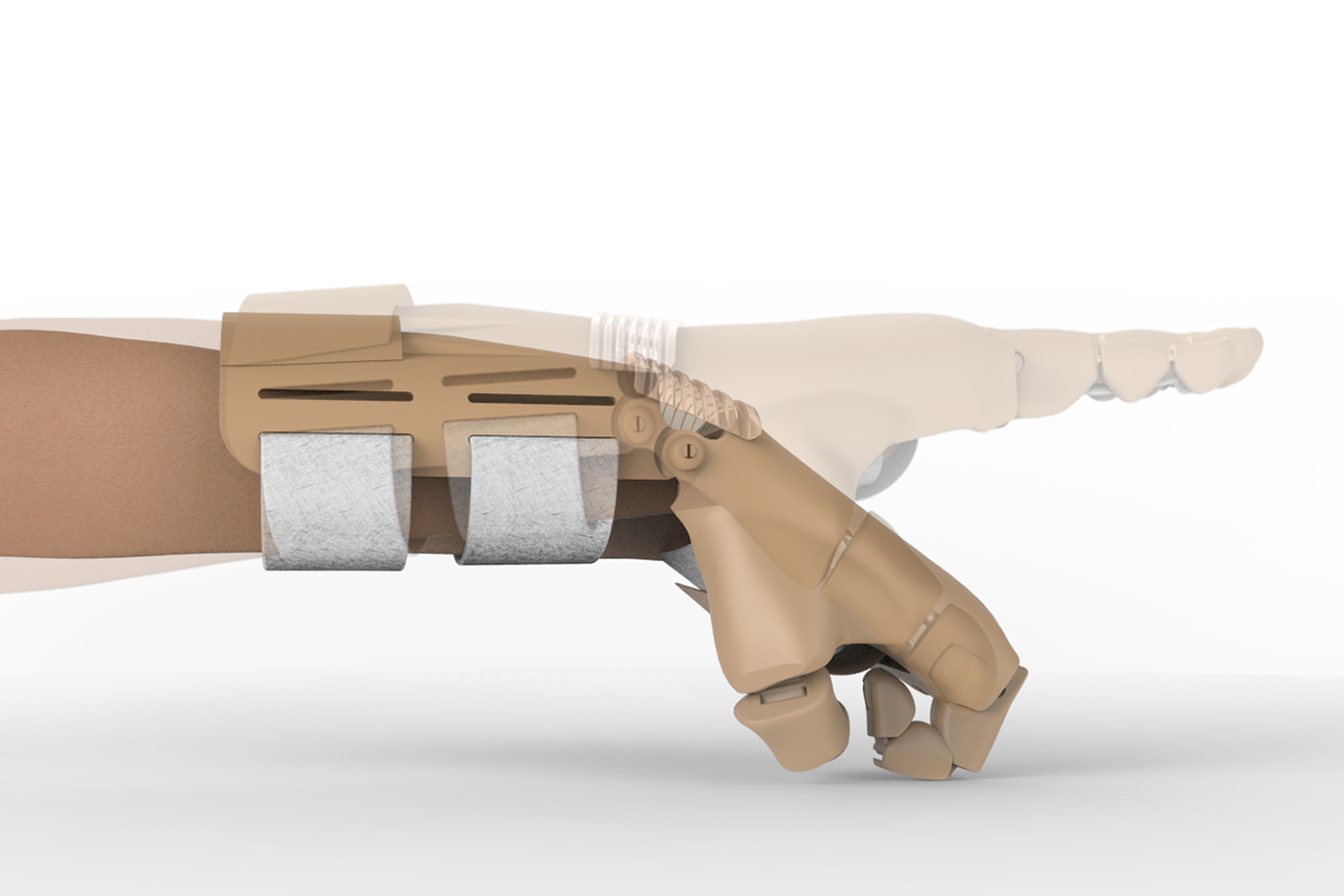 medical，Artificial hand，anthropomorphic ，industrial design，product design，