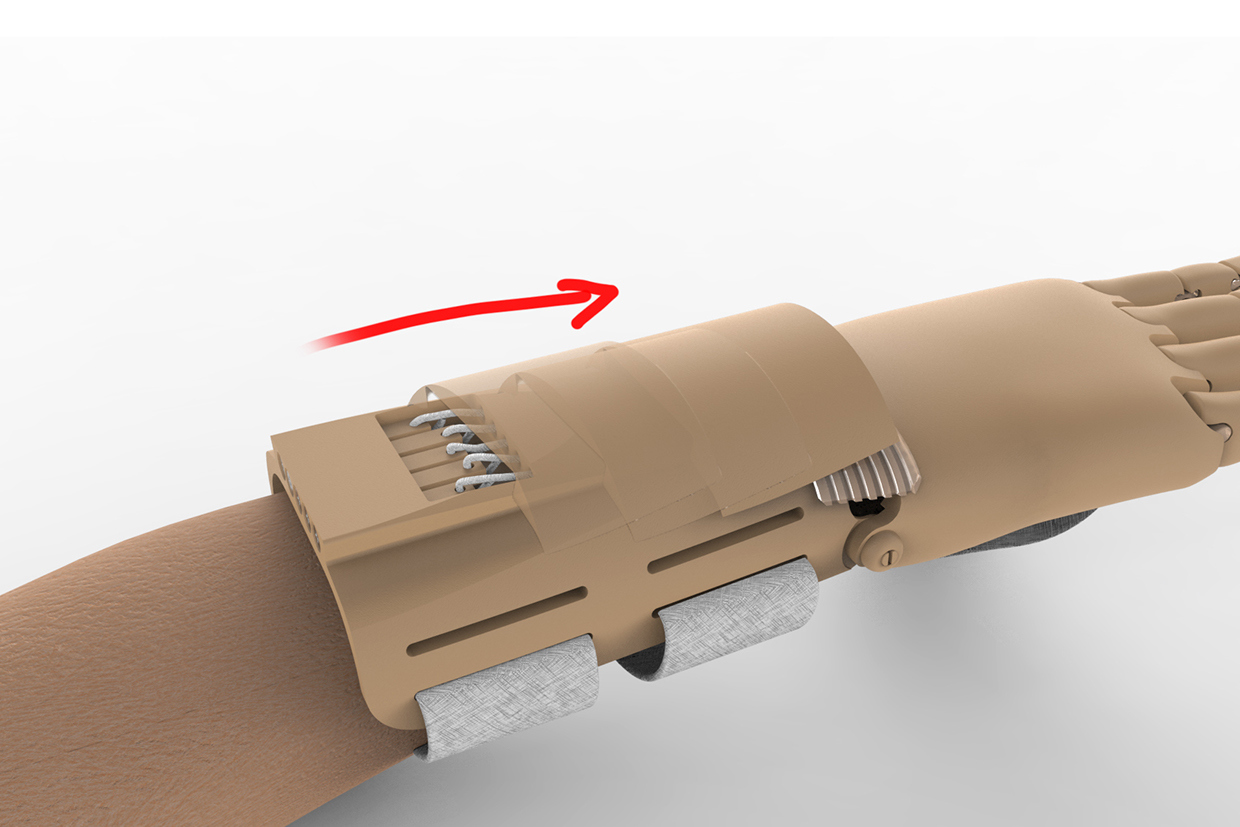 medical，Artificial hand，anthropomorphic ，industrial design，product design，