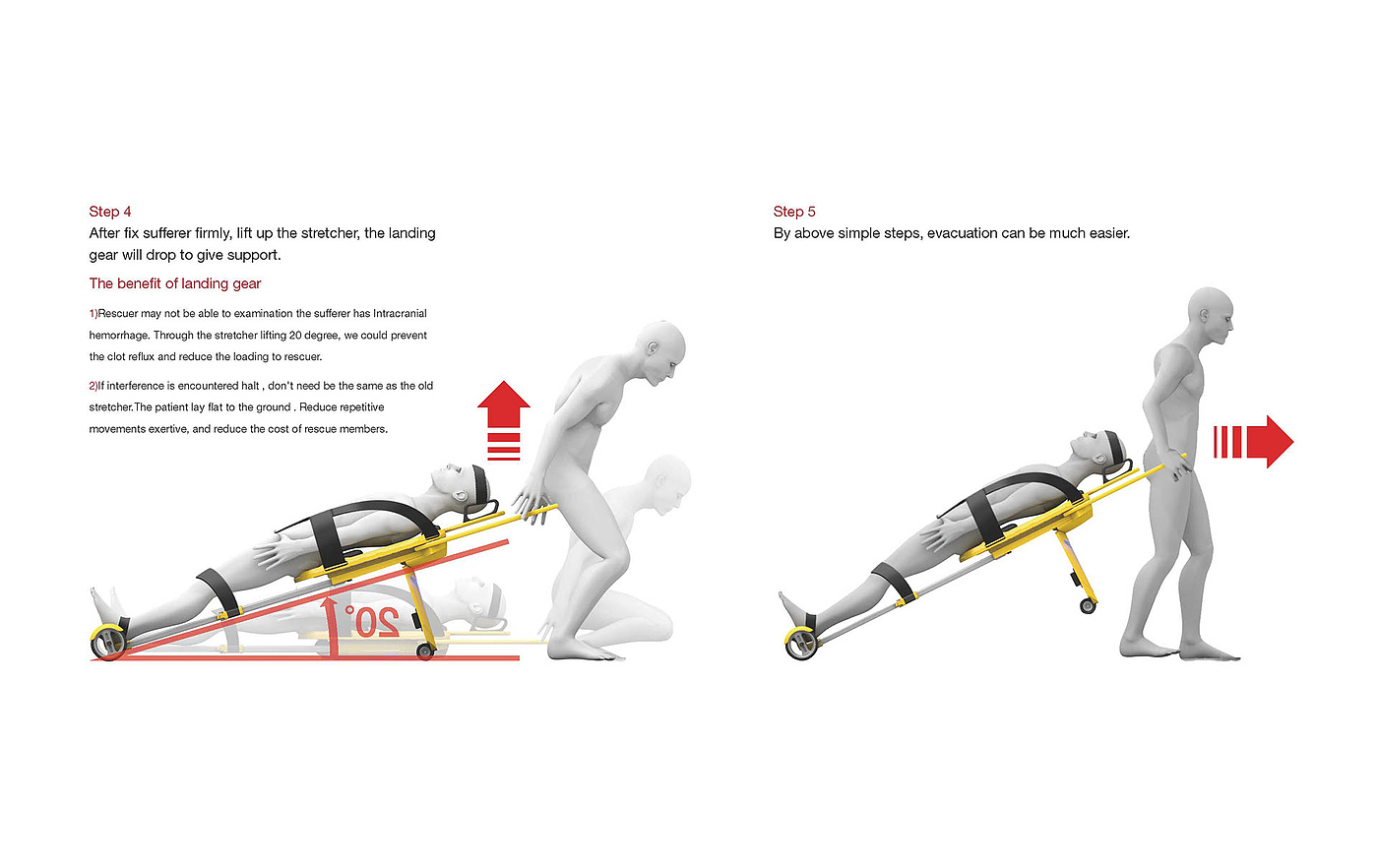 担架概念，stretcher concept，起落架，担架，