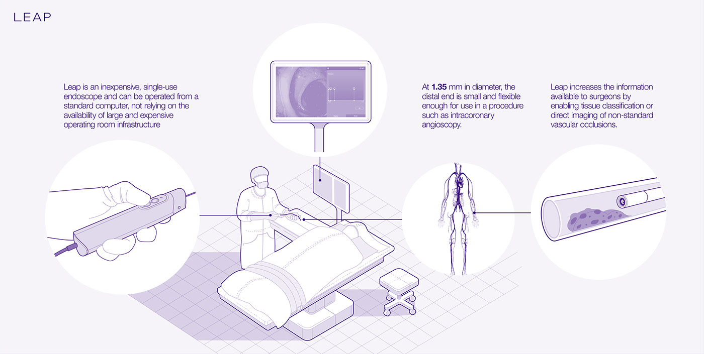 Direct imaging，artery，vein，Endoscope，