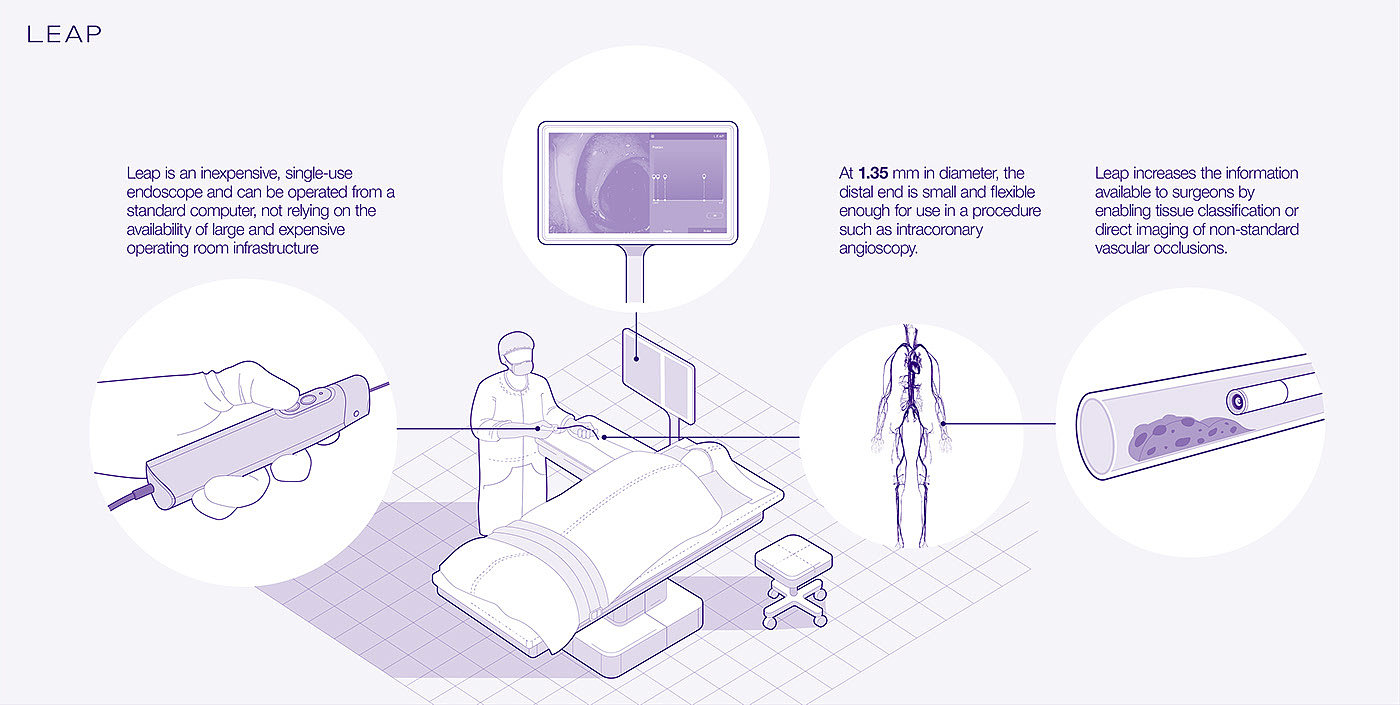 Direct imaging，artery，vein，Endoscope，