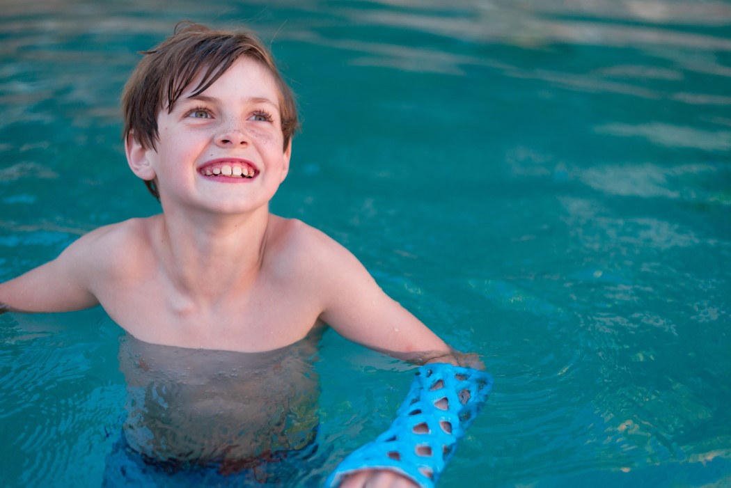 patent，Plaster，Gel: Set & Match，waterproof，Cast21，