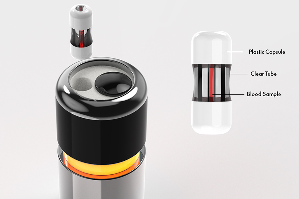 Portable，Medical equipment，Aria，Detect malaria，