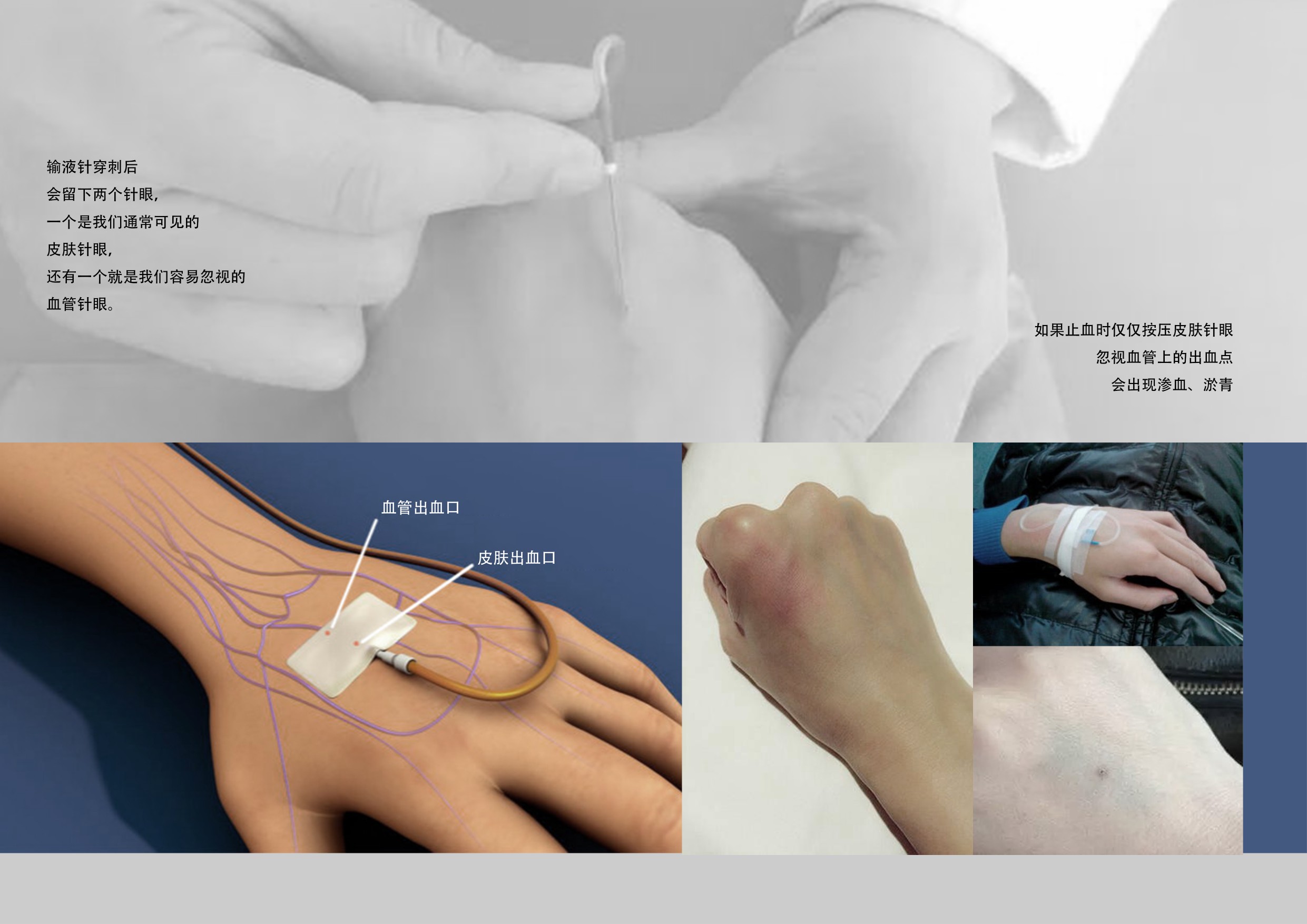 Hemostatic plaster，healthy，medical care，