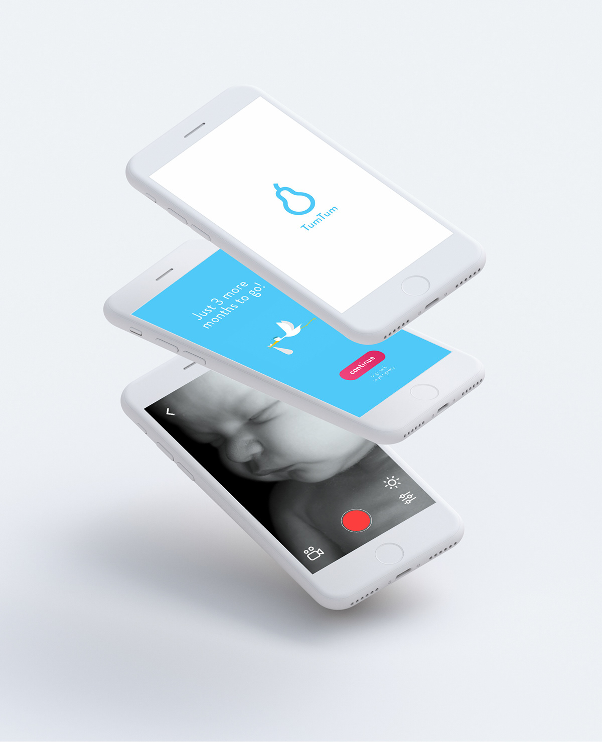 app，interactive，pregnant woman，Ultrasonic examination，Tum，
