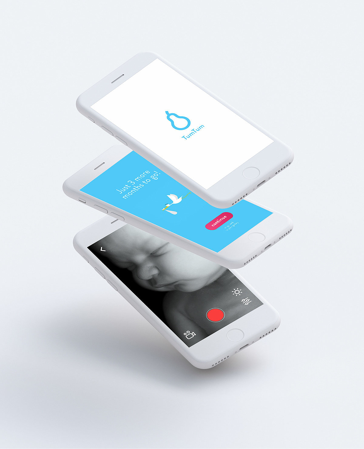 app，interactive，pregnant woman，Ultrasonic examination，Tum，
