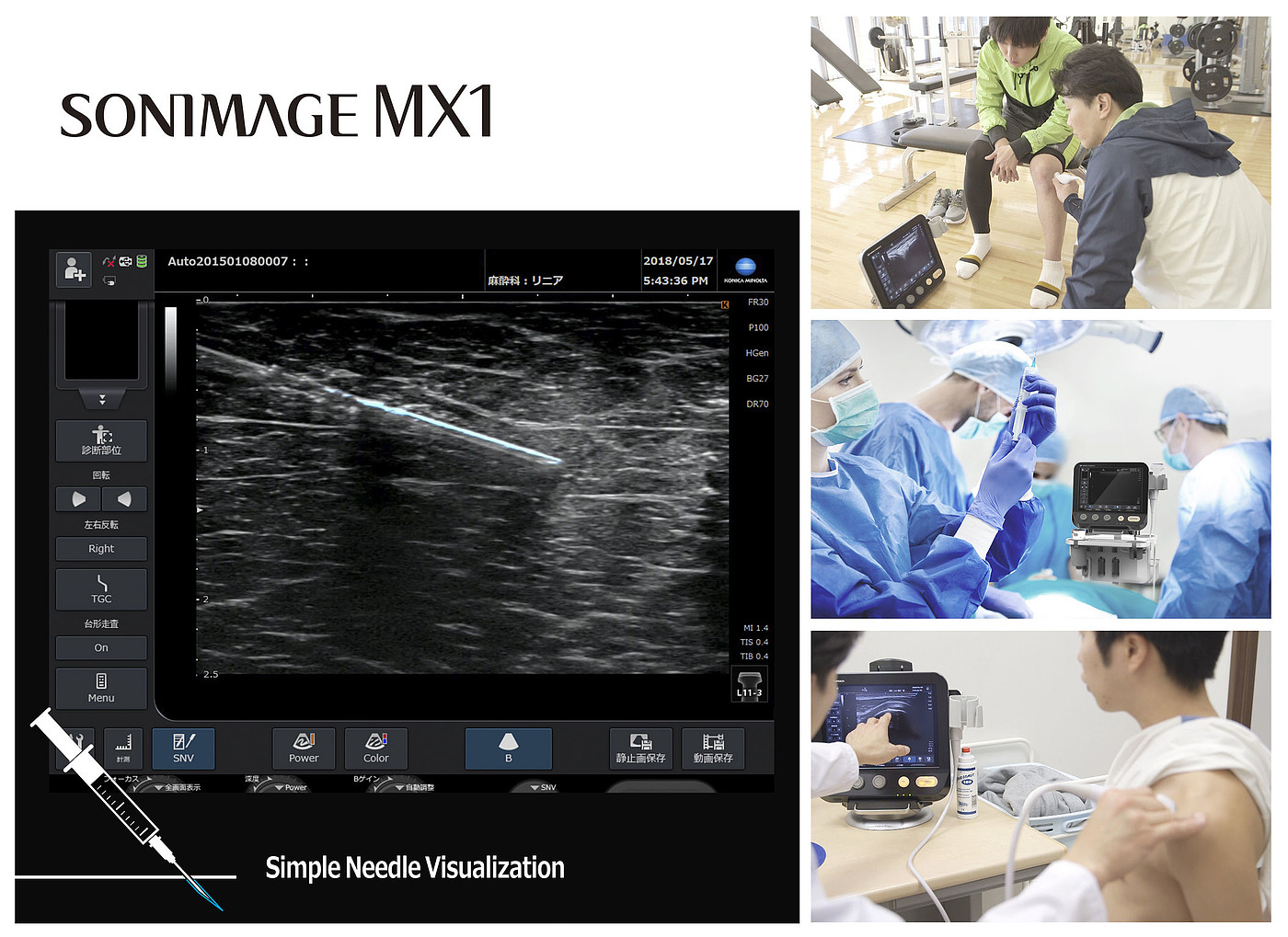 industrial design，Health care，medical apparatus and instruments，Precision instrument，If Yearbook，Design Award，