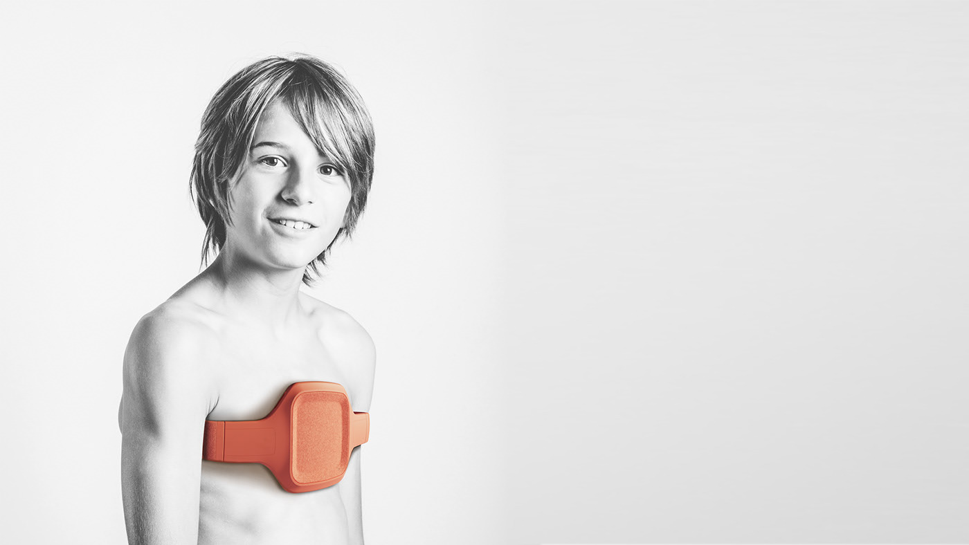 Stu Cole，If gold medal design award，Brace，Congenital thoracic deformity in children，Bracket，Carinatum pectus，orange，