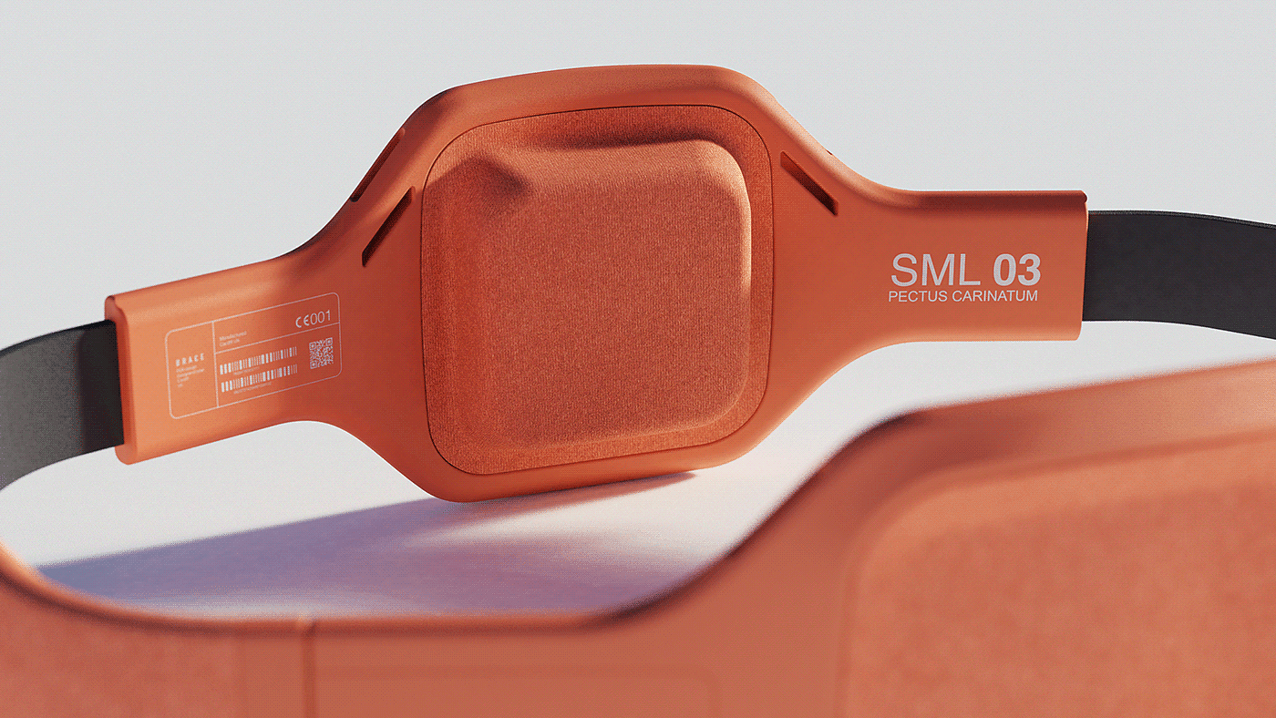 Stu Cole，If gold medal design award，Brace，Congenital thoracic deformity in children，Bracket，Carinatum pectus，orange，