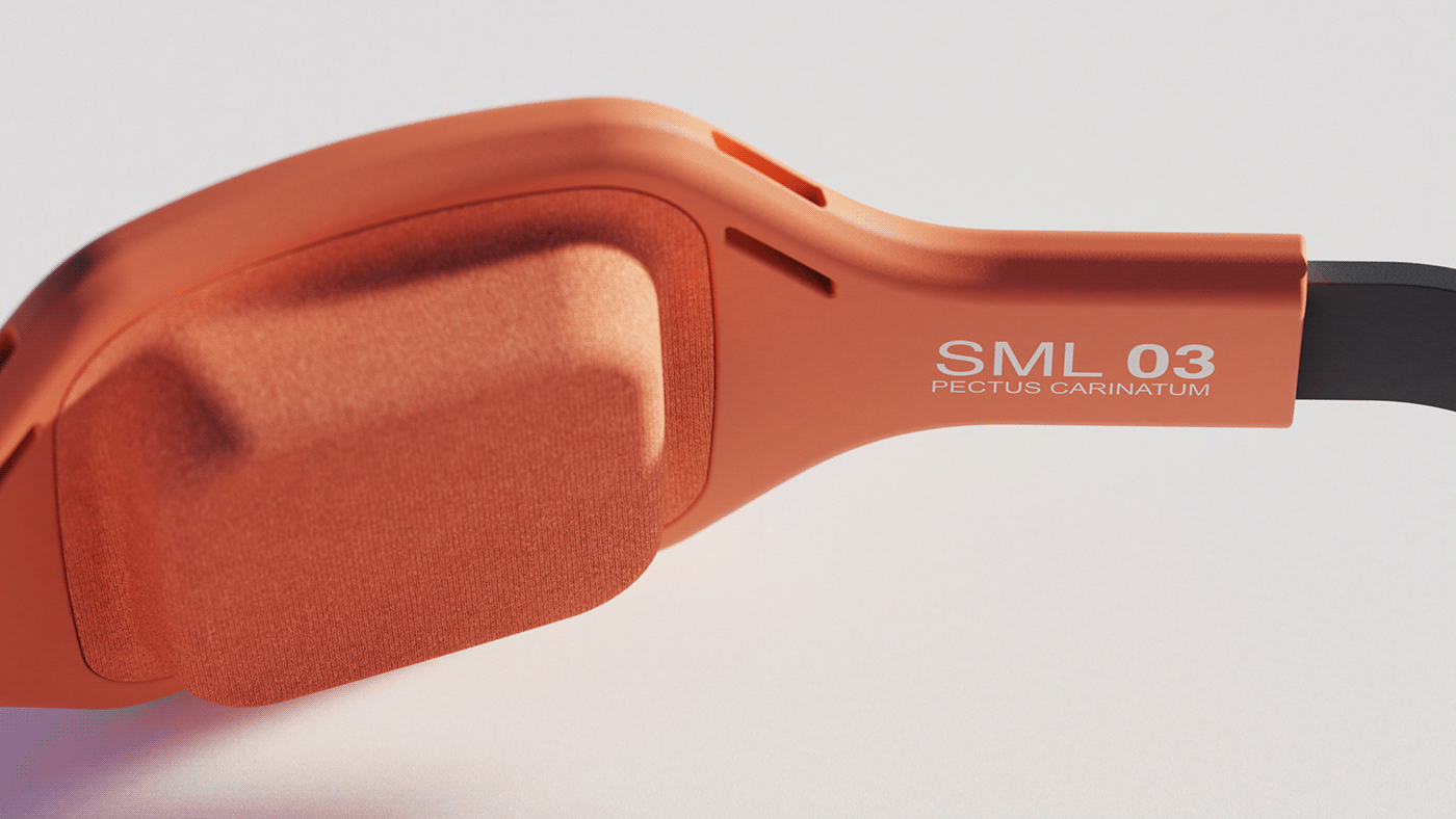 Stu Cole，If gold medal design award，Brace，Congenital thoracic deformity in children，Bracket，Carinatum pectus，orange，