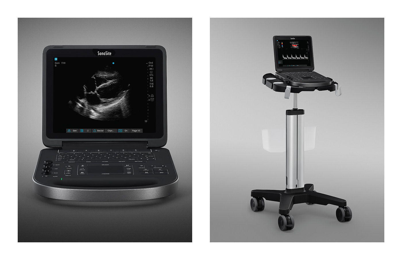 Ultrasound，Medical equipment，industrial design，product design，