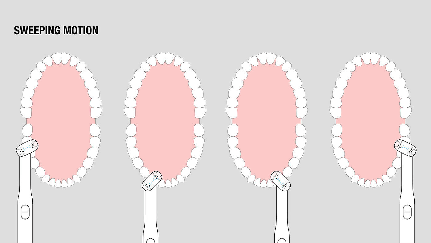 Electric toothbrush，tooth，oral cavity，hygiene，