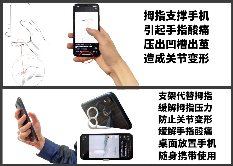 Things are nameless，Bracket artifact，