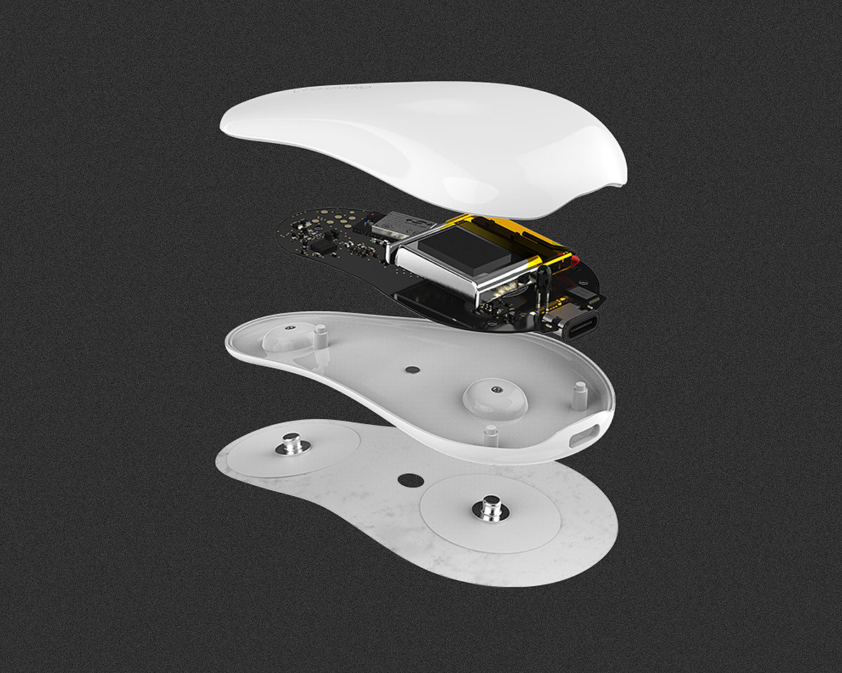 Cardioma，artificial intelligence，heart disease，wearable devices ，Health monitoring，