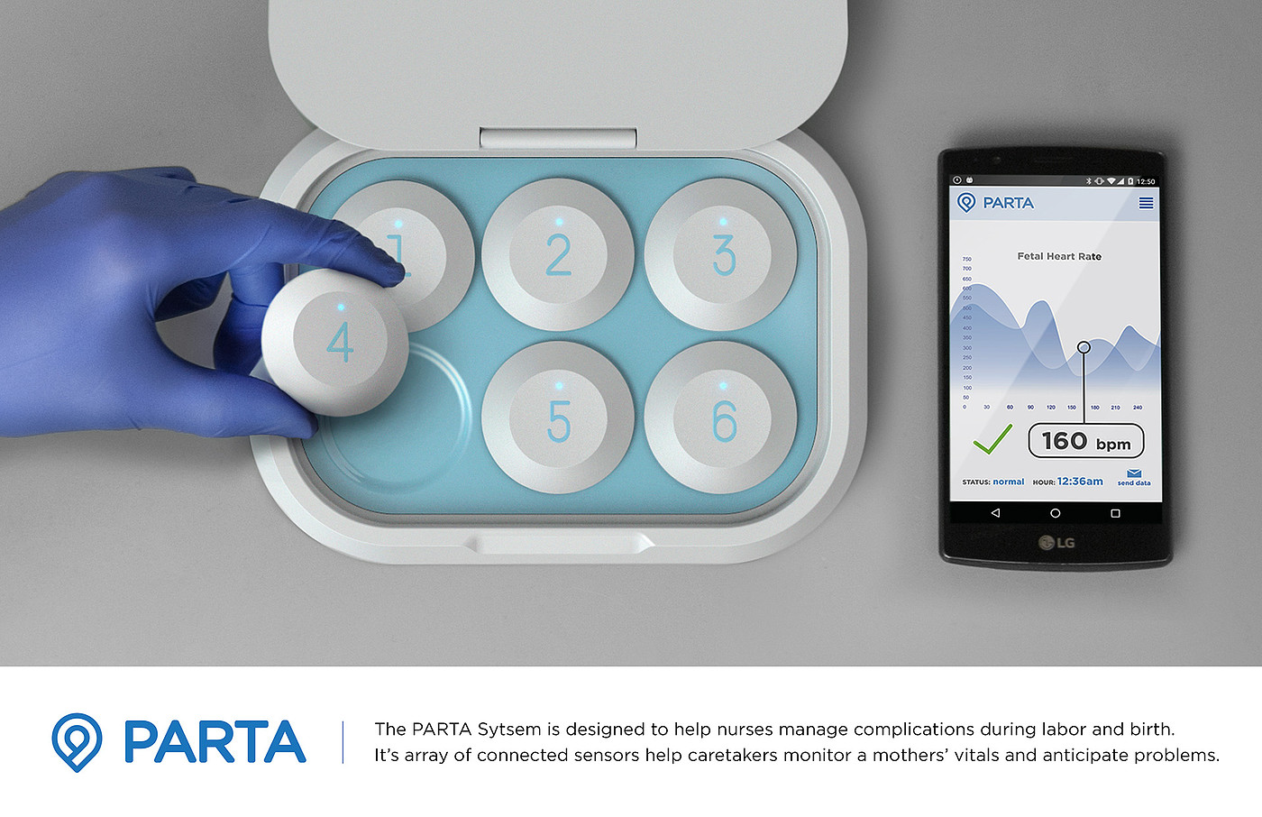 sensor，pregnant woman，complication，