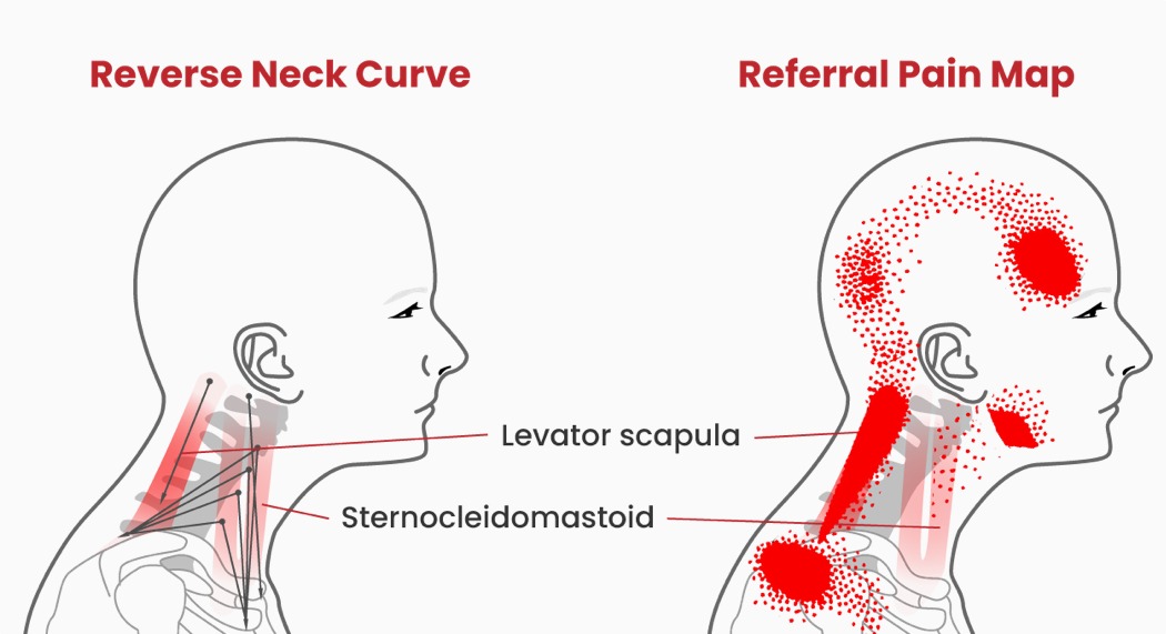 Home furniture，pillow，C-Rest，Ergonomics，cervical vertebra，comfortable，