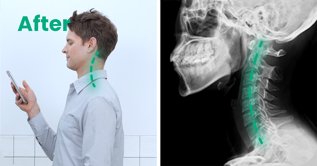 Home furniture，pillow，C-Rest，Ergonomics，cervical vertebra，comfortable，