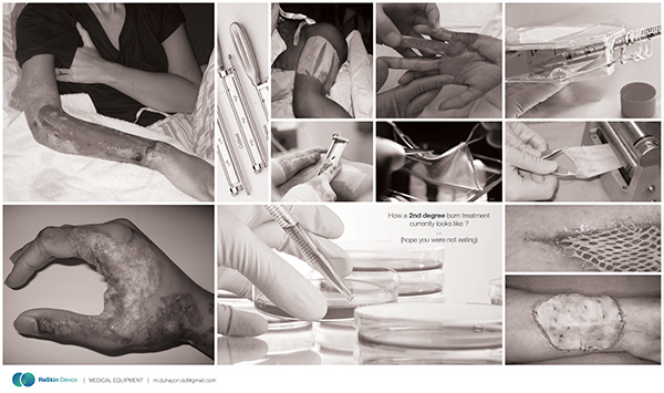 industrial design，Medical design，product design，medical，security，