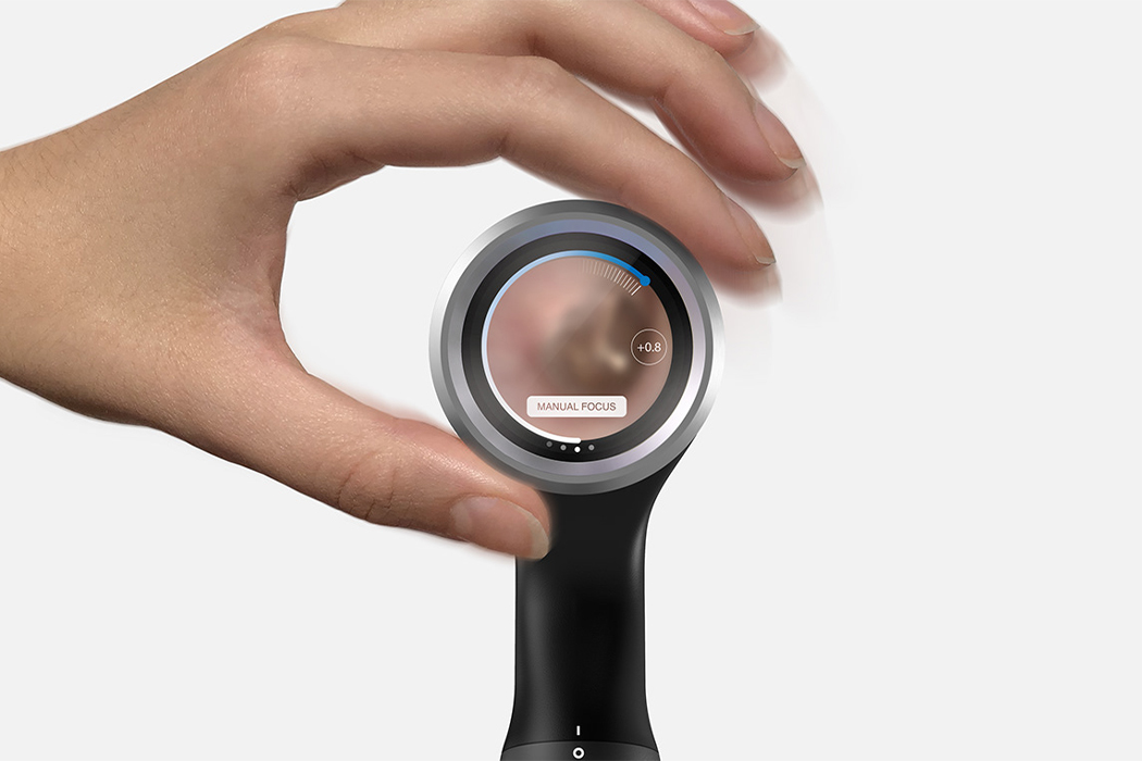 RTD，ear infection ，artificial intelligence，Ear examination tool，