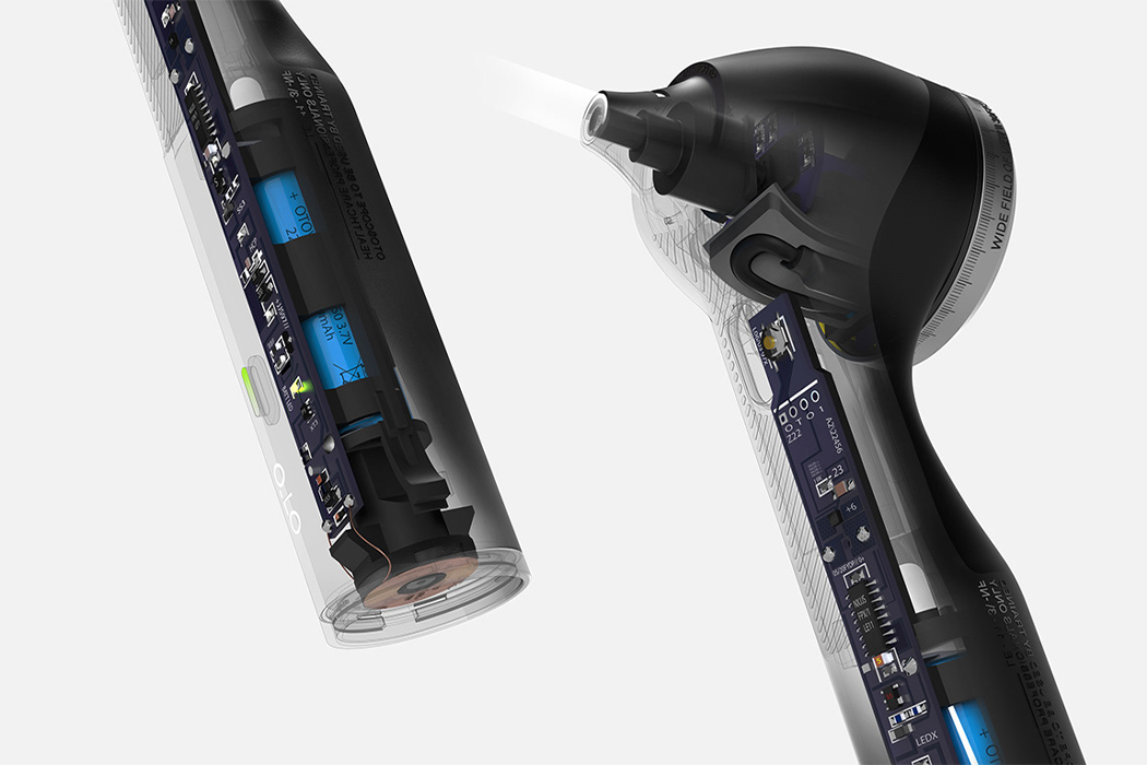 RTD，ear infection ，artificial intelligence，Ear examination tool，