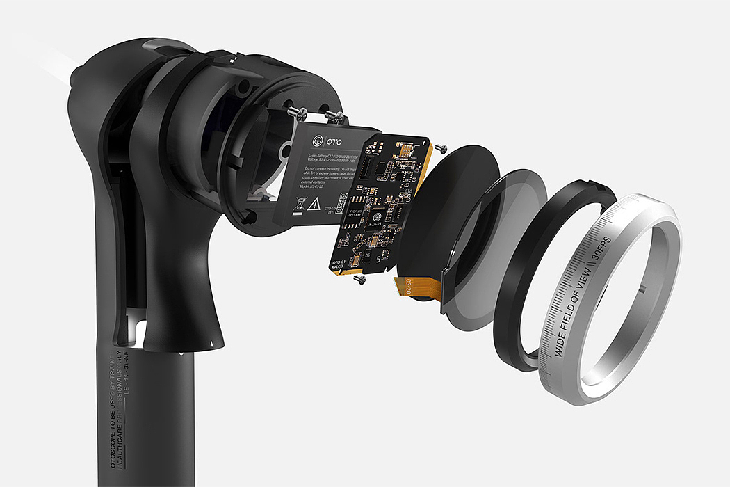 RTD，ear infection ，artificial intelligence，Ear examination tool，