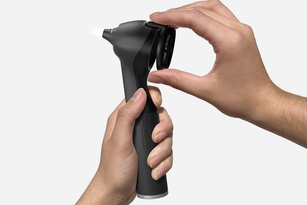 RTD，ear infection ，artificial intelligence，Ear examination tool，