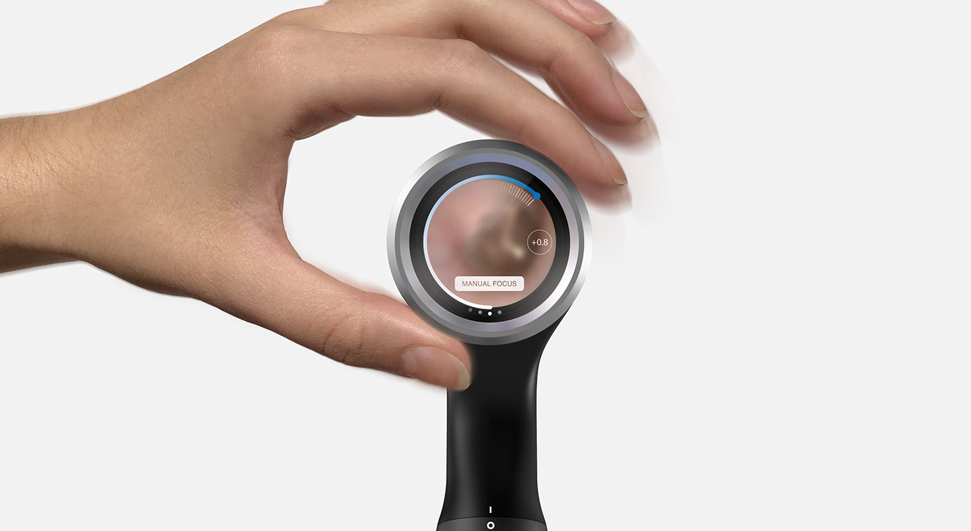 RTD，artificial intelligence，Ear examination，