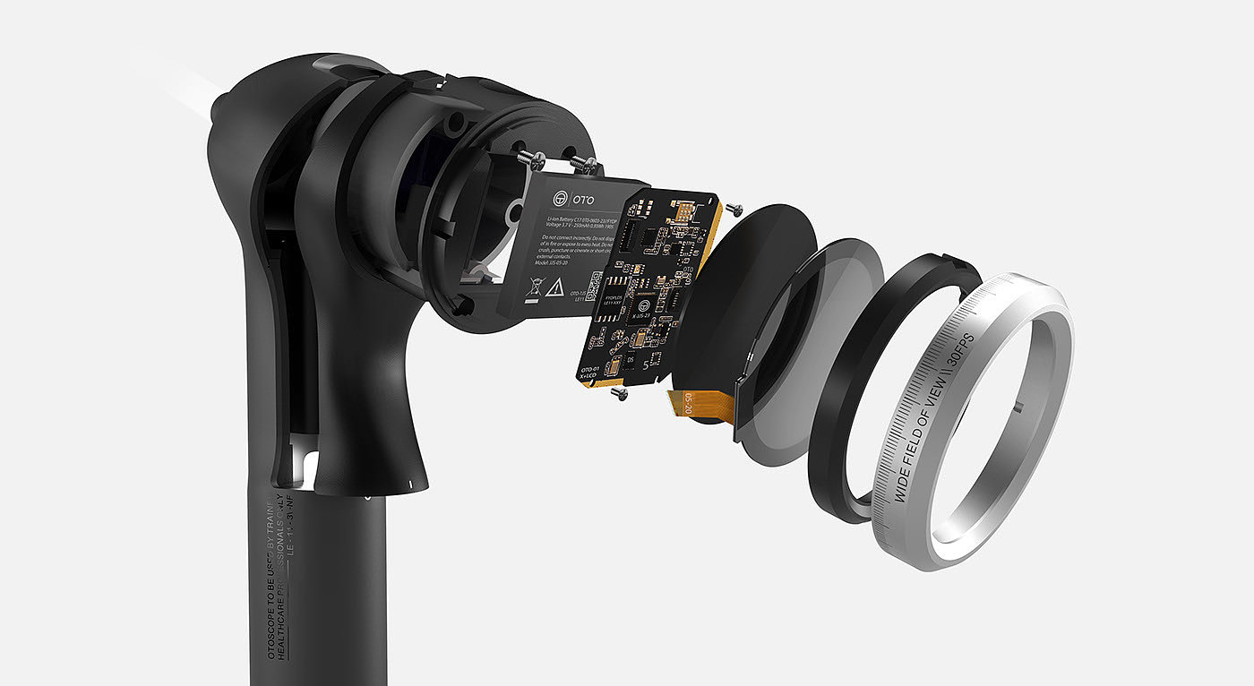RTD，artificial intelligence，Ear examination，