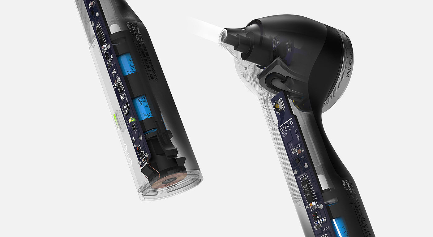 RTD，artificial intelligence，Ear examination，