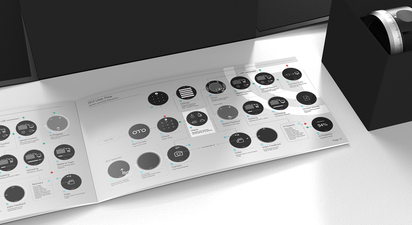 RTD，artificial intelligence，Ear examination，