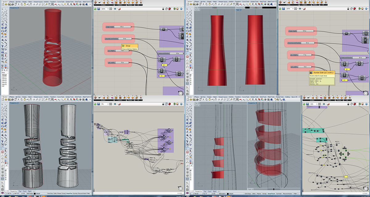 bend，finger，Medical Science，revolution，treatment，