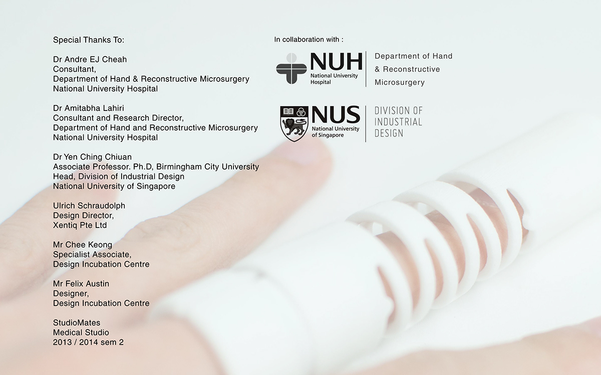 bend，finger，Medical Science，revolution，treatment，