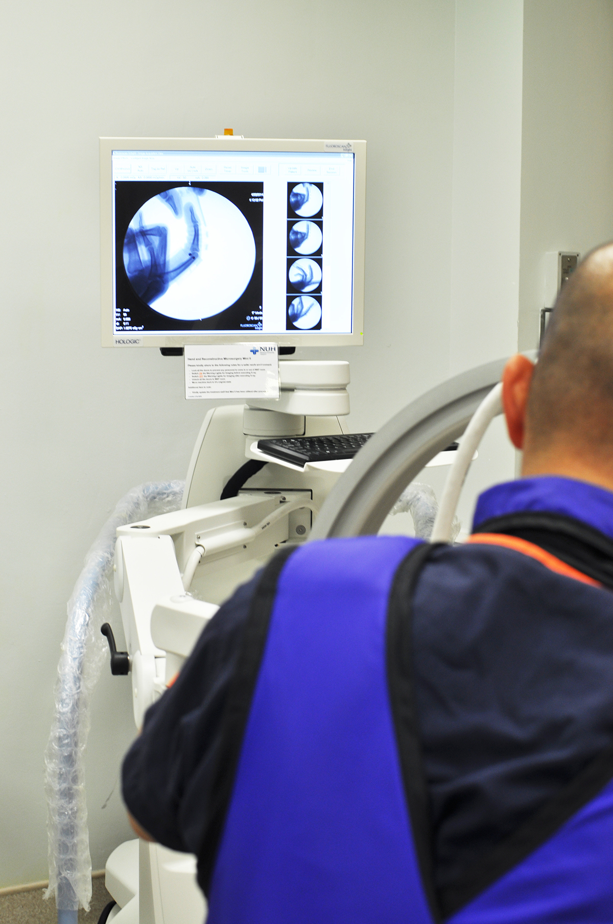 bend，finger，Medical Science，revolution，treatment，