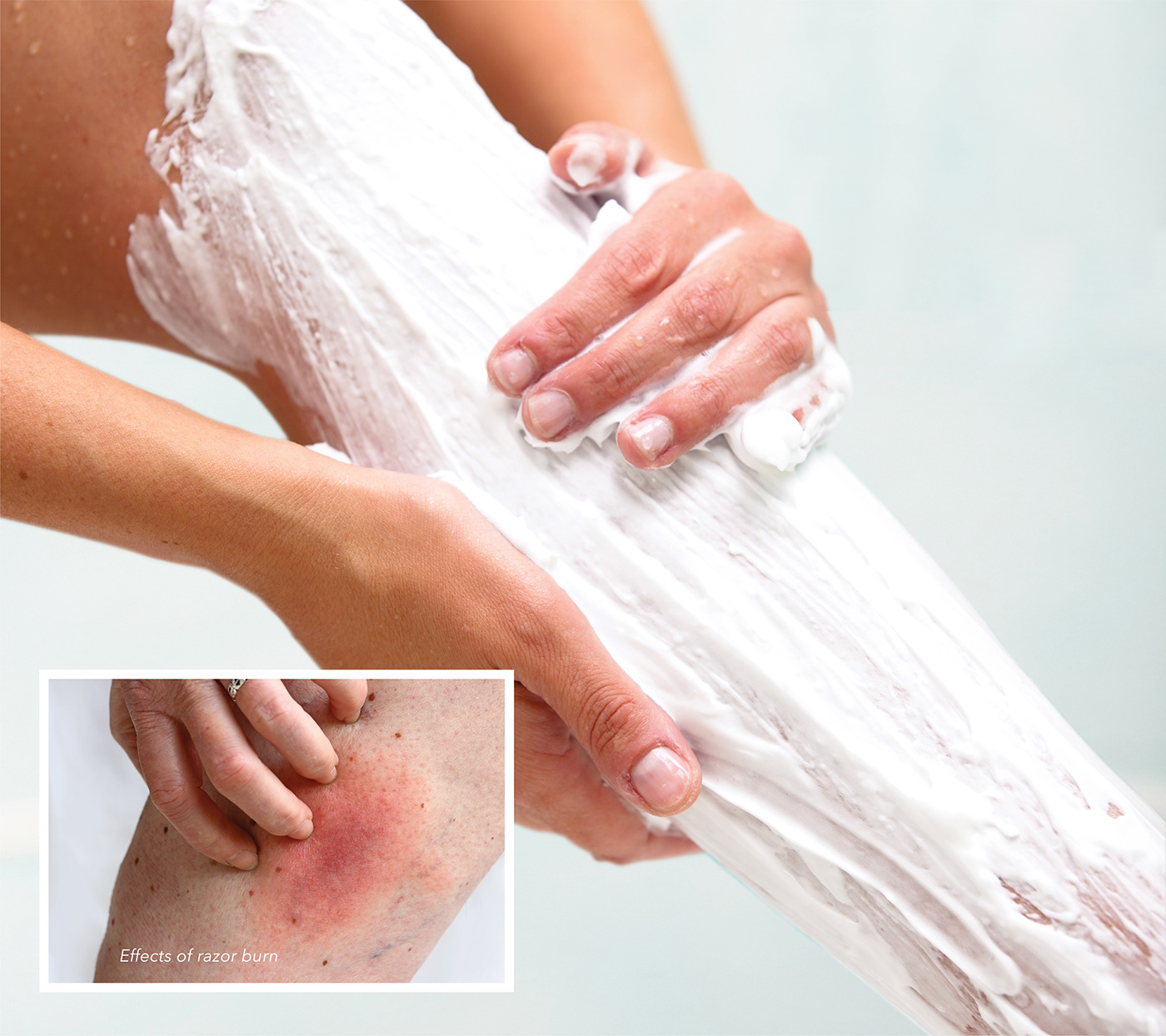 shaving，MIDI，Painless，Rolling applicator，