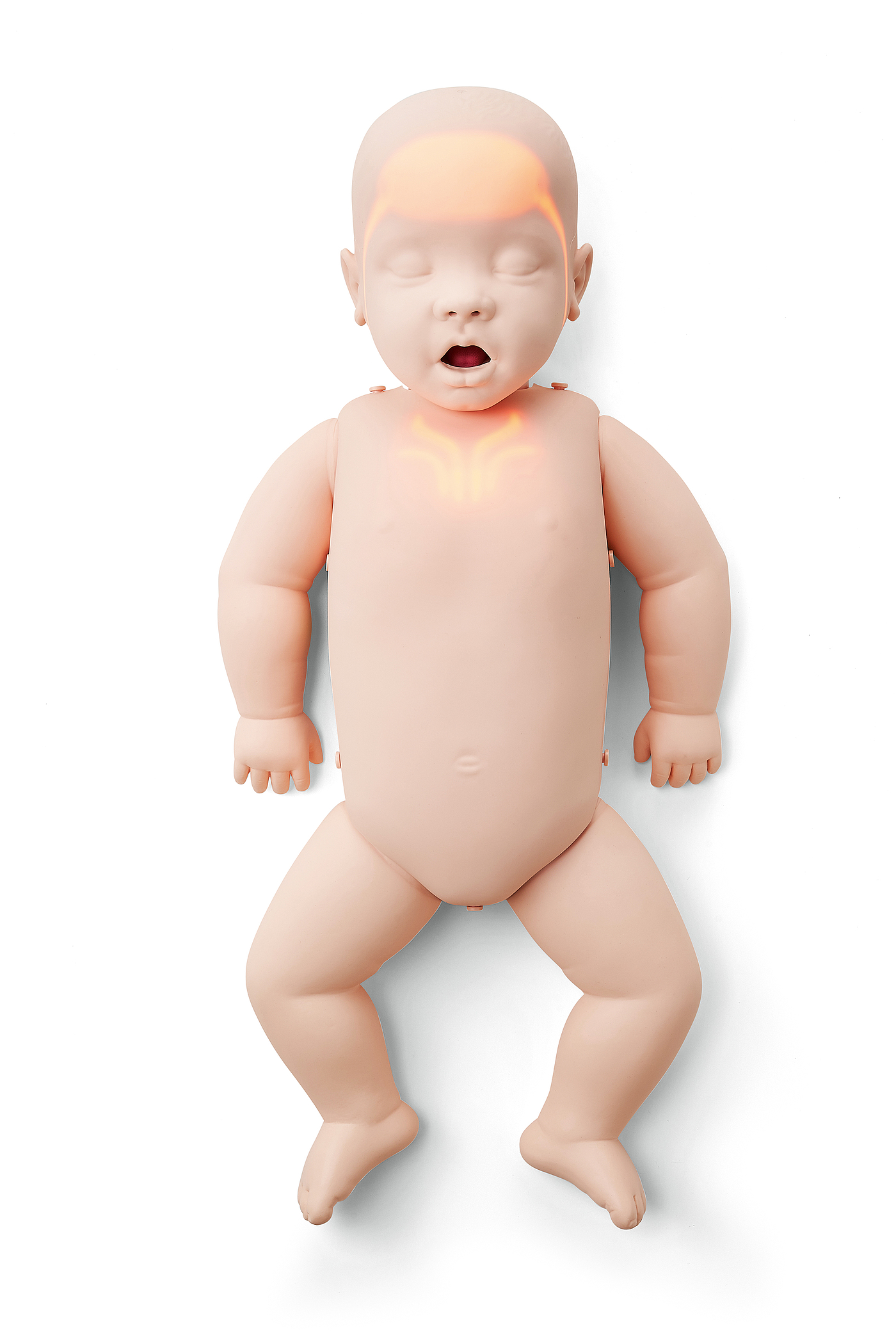 胎儿先天性大叶性肺气肿与肺囊腺瘤的鉴别-健康160