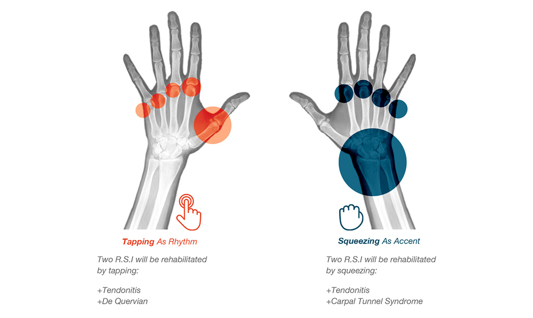 product design，industrial design，Treatment of hand trauma，musician，convenient，