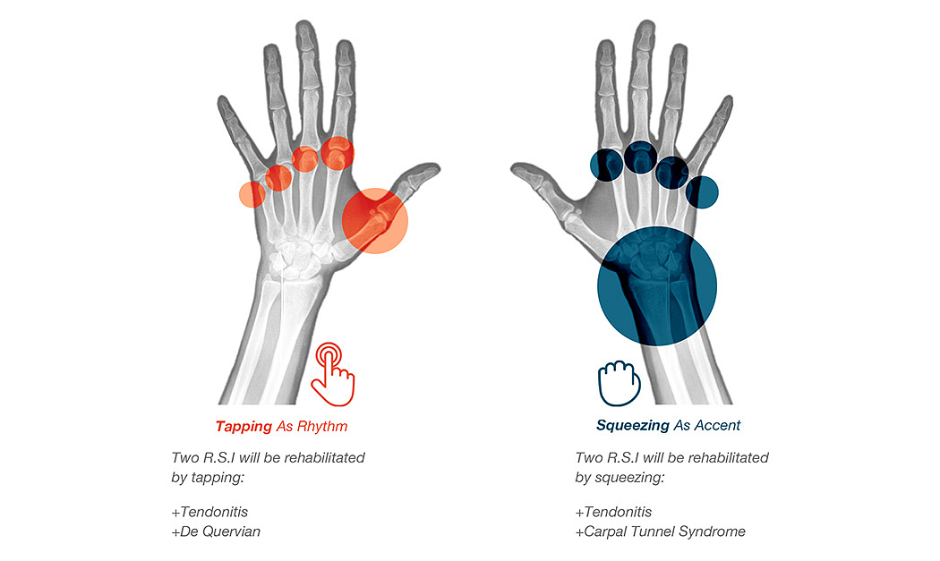 product design，industrial design，Treatment of hand trauma，musician，convenient，