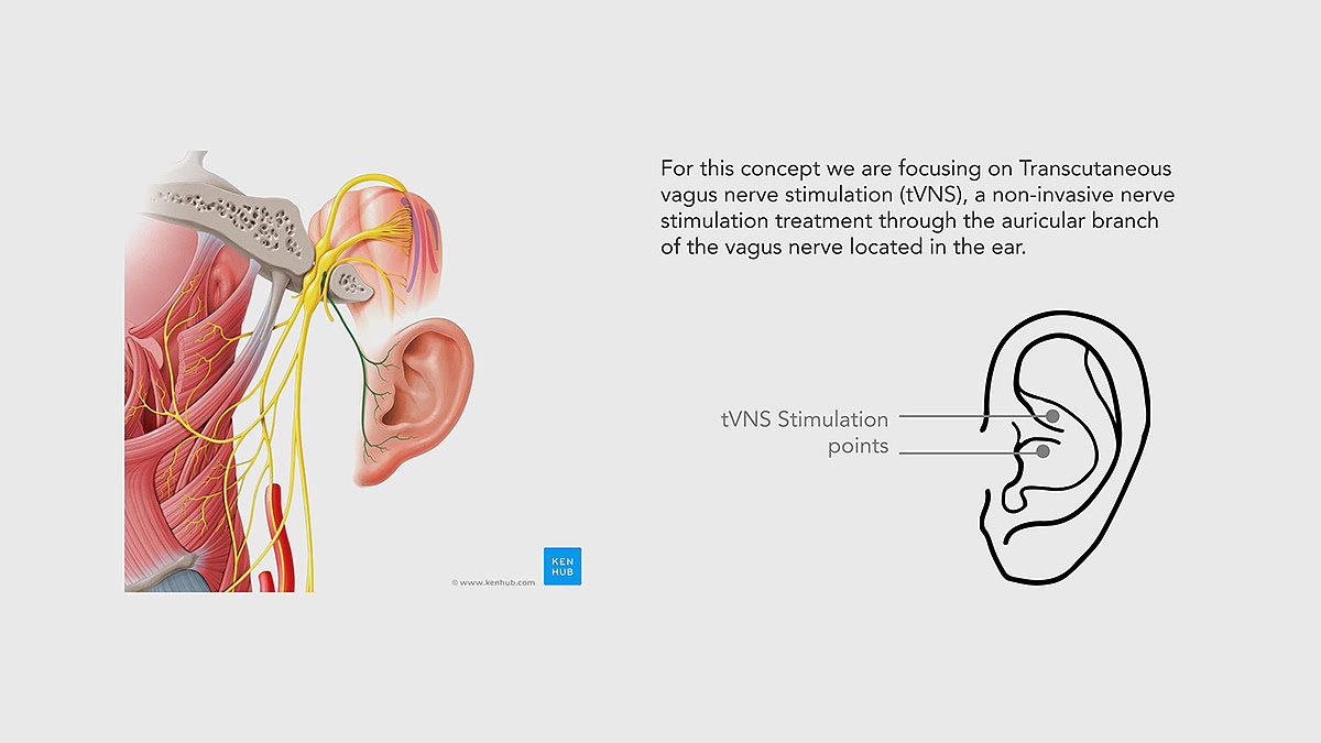 Electrical stimulation，nerve，medical care，concept，