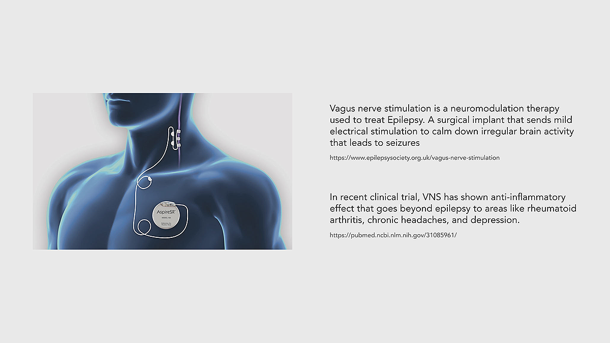 Electrical stimulation，nerve，medical care，concept，