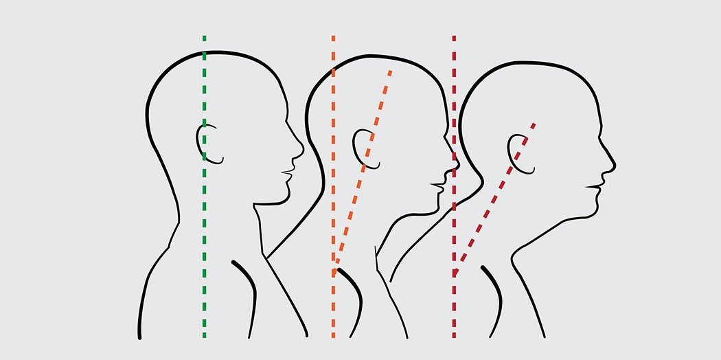 product design，industrial design，Correct sitting posture，healthy，call the police，